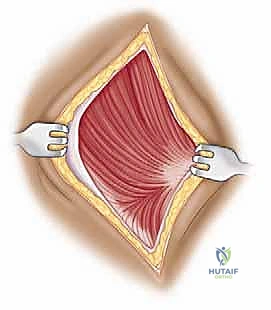 صورة توضيحية لـ مناهج جراحة الكتف وعظم العضد: دليل شامل للمرضى مع الأستاذ الدكتور محمد هطيف في صنعاء