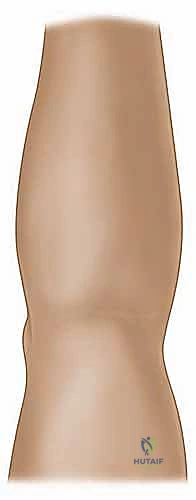 صورة طبية: مناهج جراحة الكتف وعظم العضد: دليل شامل للمرضى مع الأستاذ الدكتور محمد هطيف في صنعاء