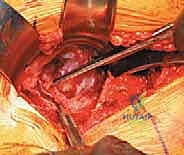 تفاصيل تشريحية لمفصل الورك