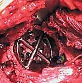 استخدام الرنين المغناطيسي للتشخيص