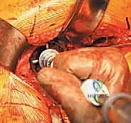 التشخيص بالأشعة السينية