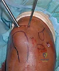 صورة توضيحية للفحص السريري وتقييم الألم في المرفق