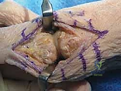 أهمية الفحص السريري الدقيق لتحديد خطة العلاج المناسبة