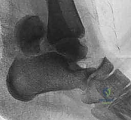 صورة شعاعية توضح بنية الكاحل