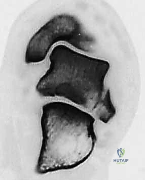 توضيح عنق وجسم الكاحل