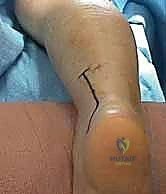 رنين مغناطيسي لمتابعة الحالة