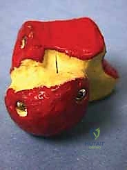 الرد المفتوح والتثبيت الداخلي