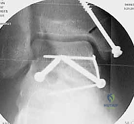 التحقق الإشعاعي في العمليات