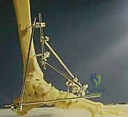 صورة طبية: كسر عظم الكاحل: الرد المفتوح والتثبيت الداخلي - دليل شامل من الأستاذ الدكتور محمد هطيف في صنعاء