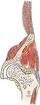 صورة توضيحية لـ جراحة أورام العظام النقيلية في الحوض: دليل شامل للمرضى مع الأستاذ الدكتور محمد هطيف