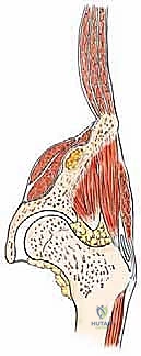 صورة توضيحية لـ جراحة أورام العظام النقيلية في الحوض: دليل شامل للمرضى مع الأستاذ الدكتور محمد هطيف