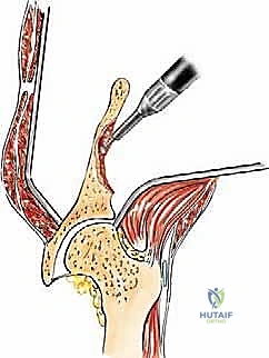 فحص الأعصاب والتأثير الوظيفي