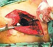 تقييم الألم والأعراض الحركية