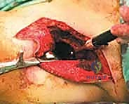 استخدام الرنين المغناطيسي في التشخيص