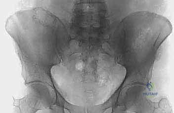 المقارنة بين الخيارات العلاجية