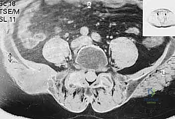 تخطيط مسار العلاج مع المريض