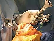 TECH FIG 3  continued E