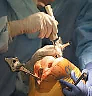 TECH FIG 3  continued E