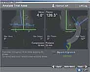 Surgical technique step for Total Knee Arthroplasty Using Navigation