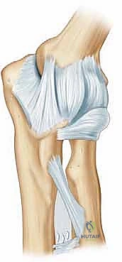 التشريح المعقد لمفصل المرفق