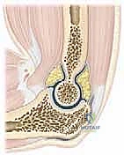 تأثير التليف على محفظة المرفق