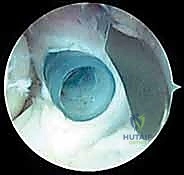 تحرير المحفظة الخلفية