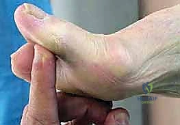 التشريح العظمي لمفصل الإبهام