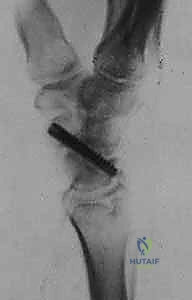 برنامج التأهيل والعلاج الطبيعي