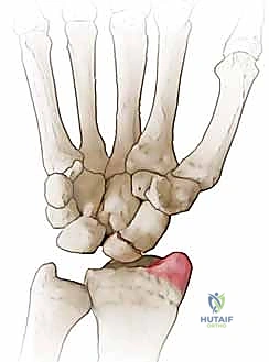 أمان الجراحة الميكروسكوبية