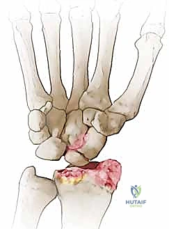 متابعة المريض بعد الجراحة