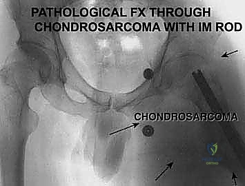 الشق الجراحي الأمامي