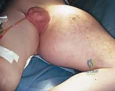 تخطيط الجراحة مع الدكتور هطيف