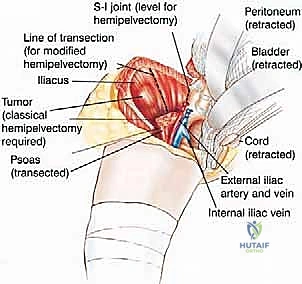 التشخيص الإشعاعي بالرنين المغناطيسي