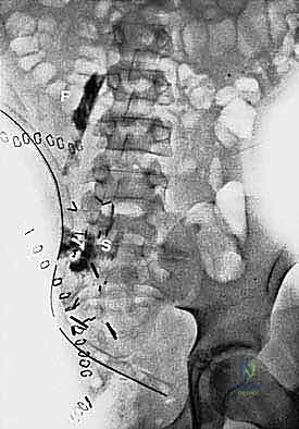 العناية المركزة بعد الجراحة