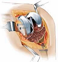 الأستاذ الدكتور محمد هطيف أثناء تقييم حالة معقدة