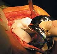 تقييم سريري لمدى حركة الركبة والألم