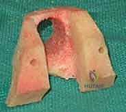 مريض يمارس العلاج الطبيعي بعد الجراحة