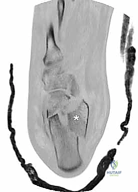 الأستاذ الدكتور محمد هطيف في غرفة العمليات
