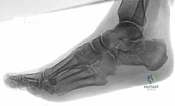 التحقق بالأشعة داخل العمليات