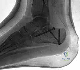 تخطيط جراحي متقدم