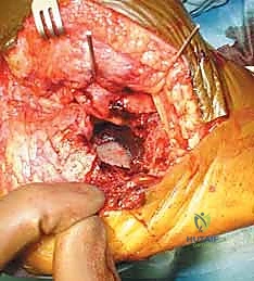 استخدام الأدوات المتخصصة