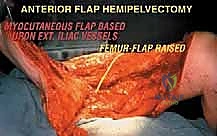 التخطيط الجراحي الدقيق قبل بدء العملية