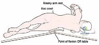 تحضير المريض في غرفة العمليات