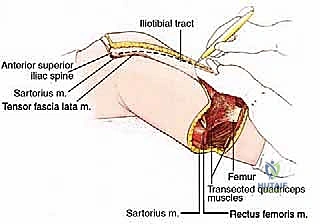 الأستاذ الدكتور محمد هطيف أثناء التقييم السريري