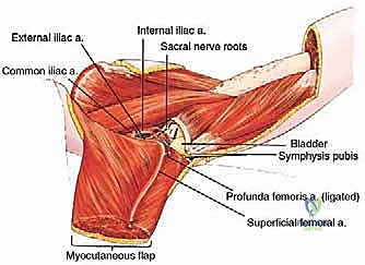 Intraoperative Surgical Step