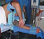 تشخيص خشونة المرفق باستخدام الأشعة المقطعية والمغناطيسية