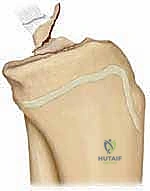 تشريح مفصل الركبة والرباط الصليبي الأمامي