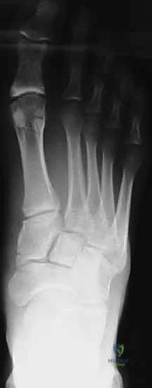 الفحص السريري الدقيق للقدم في عيادة الدكتور هطيف