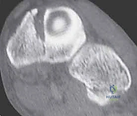 التخطيط الجراحي الدقيق لضمان أفضل النتائج