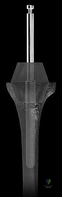 استخدام السيقان المعدنية للتثبيت